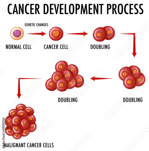 Cancer development process infographic
