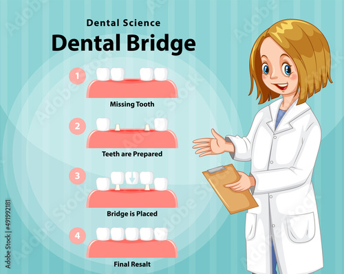 Infographic of human in dental bridge on white background