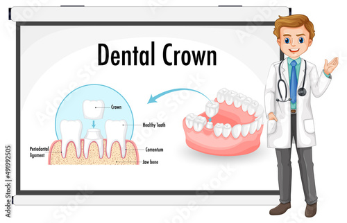 Infographic of human in dental crown