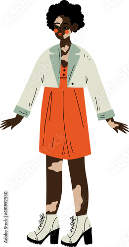 Standing African American Female with Vitiligo Loving and Proud with Her Body and Appearance