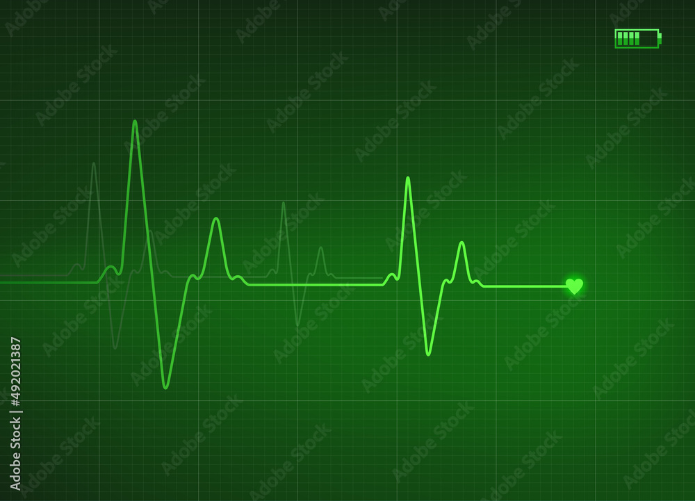 Electrocardiogram illustration in green color with battery icon Electrocardiogram illustration in green color with battery icon