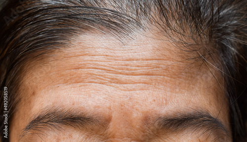 Skin creases or wrinkles at oily forehead of Southeast Asian, Myanmar or Burmese elder woman. Symptom of aging.