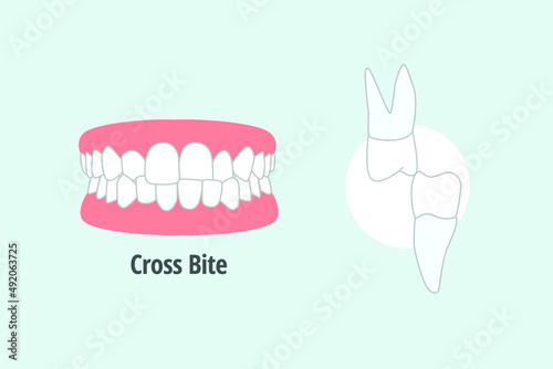 icon dental problem. vectorial illustration Cross bite