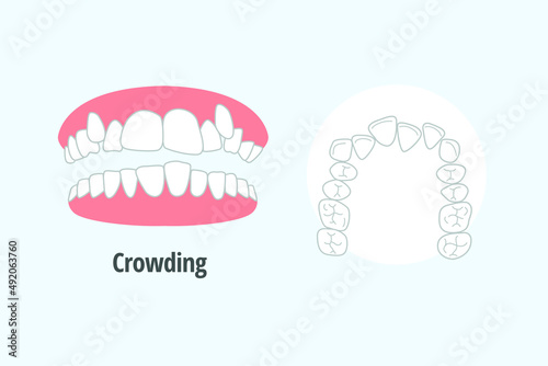 icon dental problem. vectorial illustration  Crowding