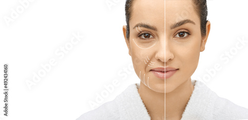 Woman's face before and after skin tightening and anti-aging procedures. Remove of wrinkles, nasolabial folds, skin rejuvenation procedure photo