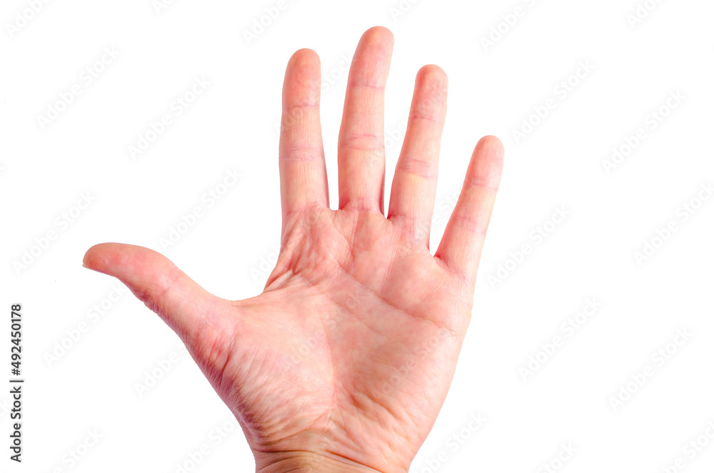 skin irritation on right wrist dermatitis skin irritation on right wrist dermatitis
