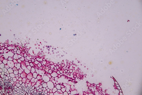 Host cells with spores (mold) are inside wood under the microscope for education.
 photo