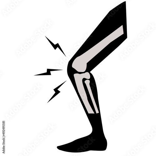acute knee pain icon on white background. Sprain injury symbol. arthritis sign. flat style.