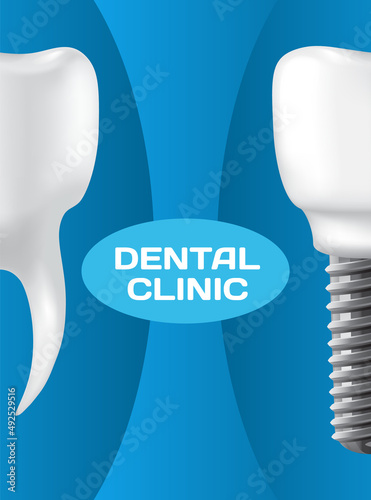 Dental clinic poster vector illustration. Advertising of hospital for teeth treatment. Medical services for installation of dental implant. Human gum with healthy teeth and denture on dentistry banner