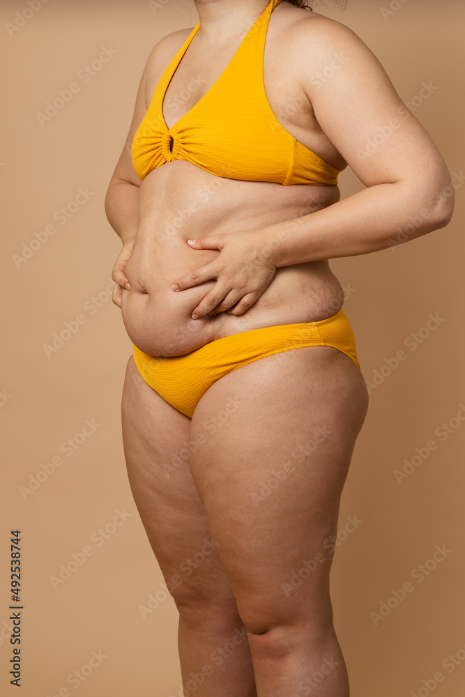 Foto Stock Cropped vertical photo overweight fat naked woman, obesity,  excess fat in yellow swimsuit. Big size. Holding stomach flabs, visceral,  cellulite. Self acceptance, body positive, plus size, friable skin | Adobe