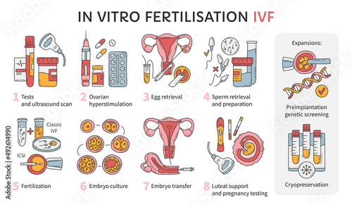 In Vitro fertilization IVF vector infographic and infertility treatment scheme. Ovarian hyperstimulation, artificial insemination, embryo culture and cryopreservation. Medical procedure for pregnancy photo