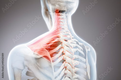 Neck pain, cervical vertebrae spine, human body anatomy