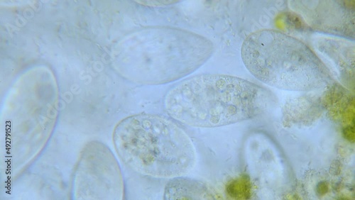 Paramecium high density population in microscope bright filed photo