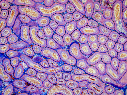 rabbit epididymis cross section under the microscope showing spermatozoa inside its tubes - optical microscope x100 magnification