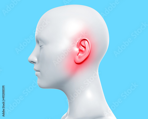3d render artwork illustration of female gray colored figure with ear inflammation on blue background.