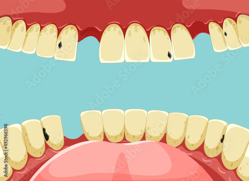Human teeth inside mouth with yellow broken tooth