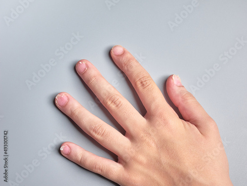 Hand of a 9 year old boy with brittle nails isolated on gray background, nails disease photo