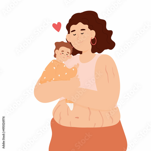 Woman with stretch marks on her stomach after pregnancy