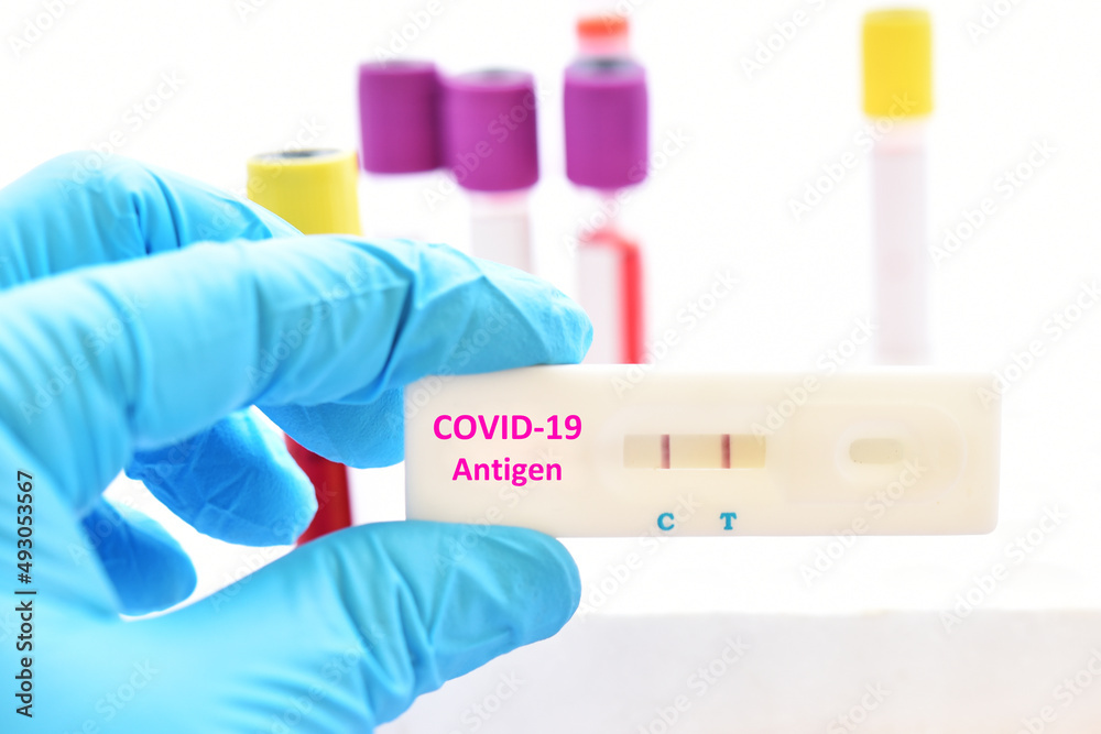 COVID-19 positive test result by using COVID-19 antigen test kit or ATK, rapid test method COVID-19 positive test result by using COVID-19 antigen test kit or ATK, rapid test method
