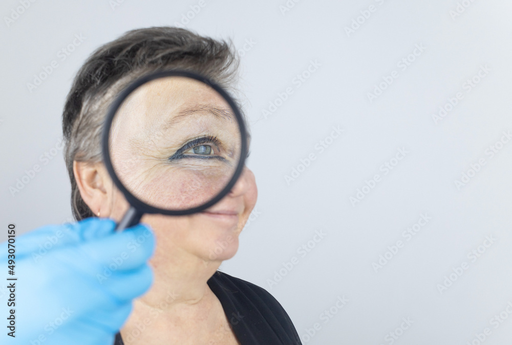 Senior woman at the reception of a facial plastic surgeon. Consultation on the removal of age wrinkles on the face. Doctor shows what procedures he will do. Mimic wrinkles. Magnifying glass in hands Senior woman at the reception of a facial plastic surgeon. Consultation on the removal of age wrinkles on the face. Doctor shows what procedures he will do. Mimic wrinkles. Magnifying glass in hands
