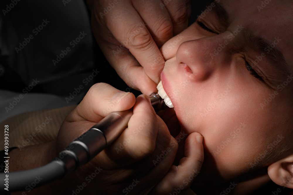 Obraz premium Visiting a dentist, brushing a tooth with a drill, a schoolboy at a pediatric dentist.