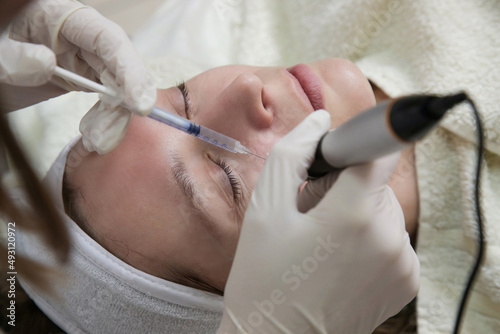 Mesotherapy. Woman having dermapen facial treatment. Micro needle cosmetic treatment at dermatologist.