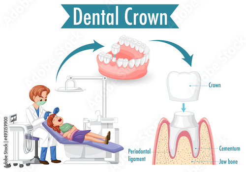 Infographic of human in dental crown on white bacground