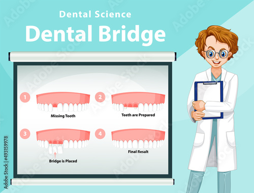 Infographic of human in dental bridge