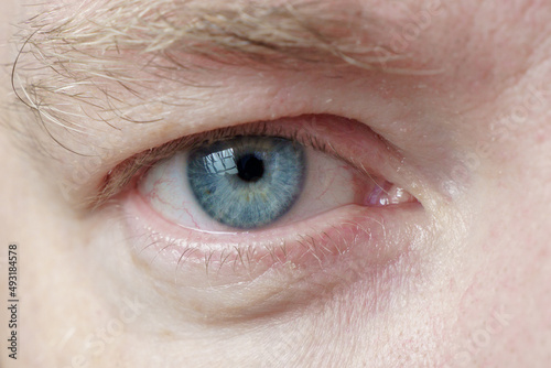 Right eye of a white male close-up, soft focus. The human eye with a blue pupil