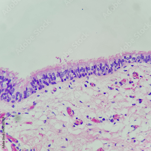 Camera photo of benign respiratory epithelium, showing cilia along luminal surface, magnification 400x, photograph through a microscope photo