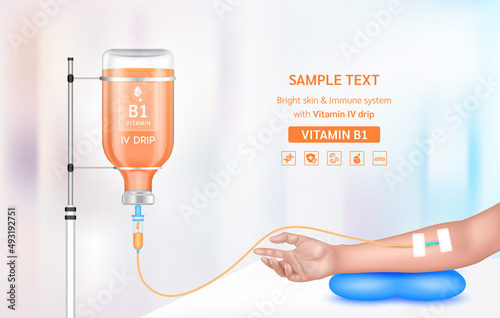 Vitamin iv drip treatment. Needle Intravenous for infusion on arm in clinic with warm tone. Vitamin B1 serum collagen orange inside saline bottle. Medical and beauty concept. Vector EPS 10.