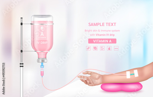 Vitamin iv drip treatment. Needle Intravenous for infusion on arm in clinic with warm tone. Vitamin A serum collagen pink inside saline bottle. Medical and beauty concept. Vector EPS 10.