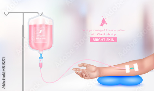 Intravenous vitamin iv drip treatment in spa salon, clinic. Serum collagen vitamin inside saline bag for beauty pink. Used for giving injections for health and beauty bright skin. Vector EPS 10.