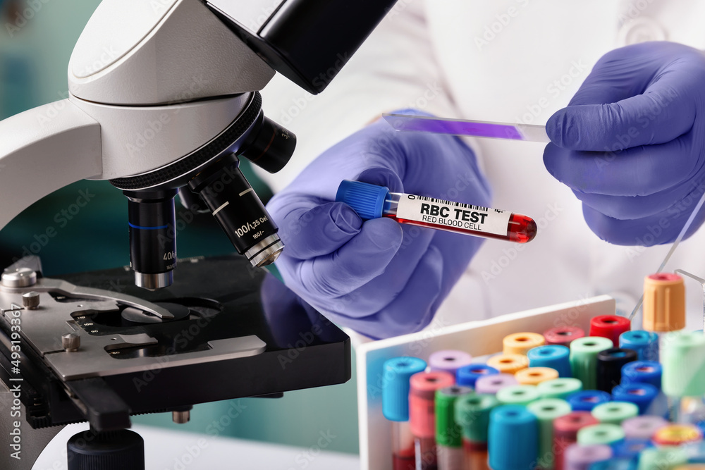 doctor with Blood tube for RBC Red Blood Count test in lab. Blood sample of patient for RBC Red