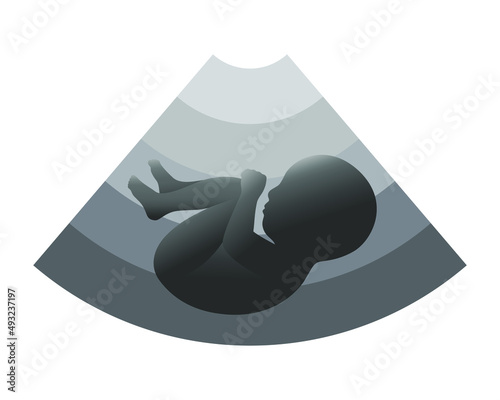 Fetus ultrasound graphic icon. Symbol ultrasound examination pregnancy. Sign isolated on white background. Vector illustration