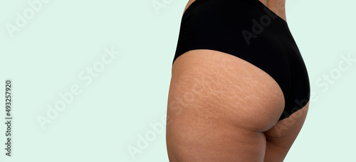 Close up stretch marks on Asian woman buttocks Isolated on light green background, copy space for text.