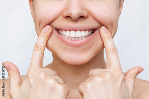Cropped shot of young caucasian woman demonstrating the beautiful smile with her hands isolated on a white background. Teeth whitening. Oral hygiene, dental health care, perfect even teeth. Dentistry
