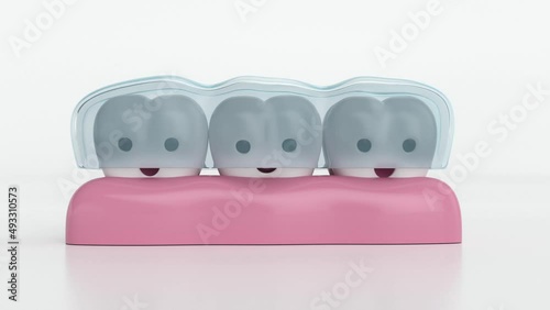 invisible braces, invisalign, happy teeth with invisible braces, 3d animation photo