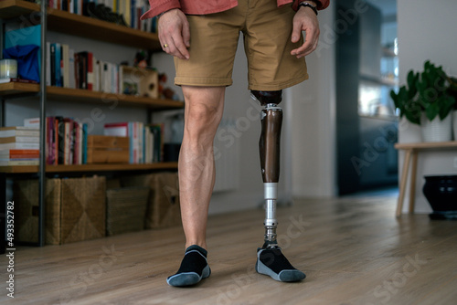 Crop person with leg prosthesis photo