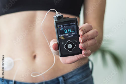 Tableau sur toile Woman holding an insulin pump