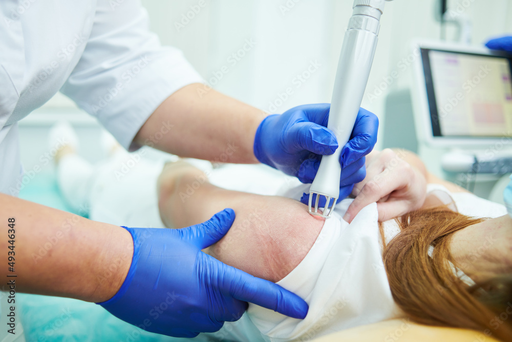 Laser cosmetic surgery and skin resurfacing in dermatology Laser cosmetic surgery and skin resurfacing in dermatology