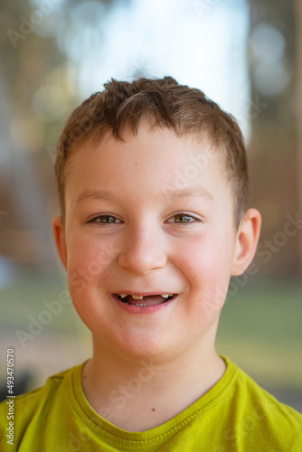 cute boy with fallen teeth