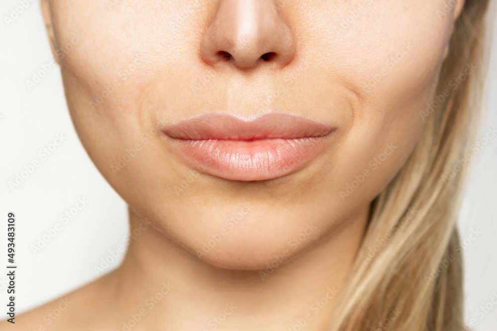 Cropped shot of young caucasian blonde woman's face with perfect lips after lip enhancement. Injection of filler in lips on a white background. Lip augmentation. Close up Cropped shot of young caucasian blonde woman's face with perfect lips after lip enhancement. Injection of filler in lips on a white background. Lip augmentation. Close up