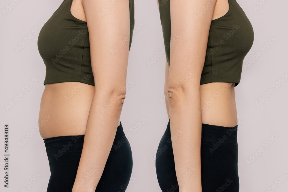 Young woman in profile with a belly with excess fat and toned slim stomach with abs before and after losing weight isolated on a beige background. Result of diet, liposuction, training