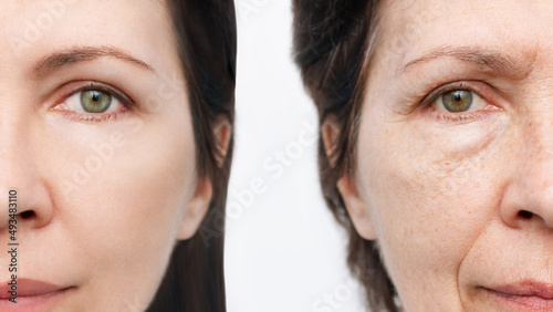 Comparison of the face of young and aged women. Youth, old age. The process of aging and rejuvenation, the result years later. Beauty treatments and lifting. Age-related changes,appearance of wrinkles photo