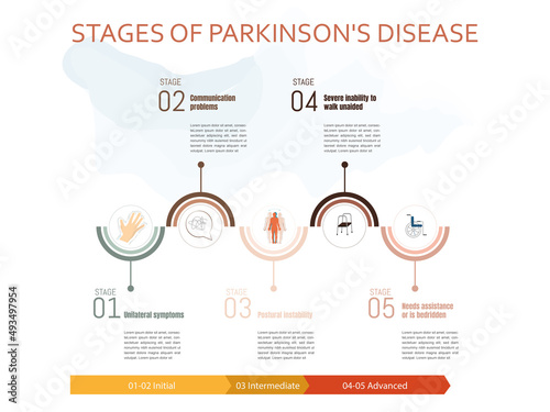 Stages of Parkinson's disease photo