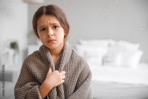 Little girl ill with chicke...
