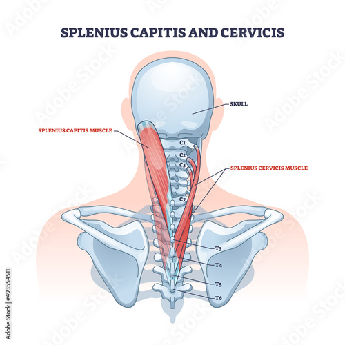 Splenius capitis and cervicis muscle location in human neck outline diagram. Labeled educational scheme with spinal vertebrae discs and muscular system vector illustration. Upper body physiology. photo