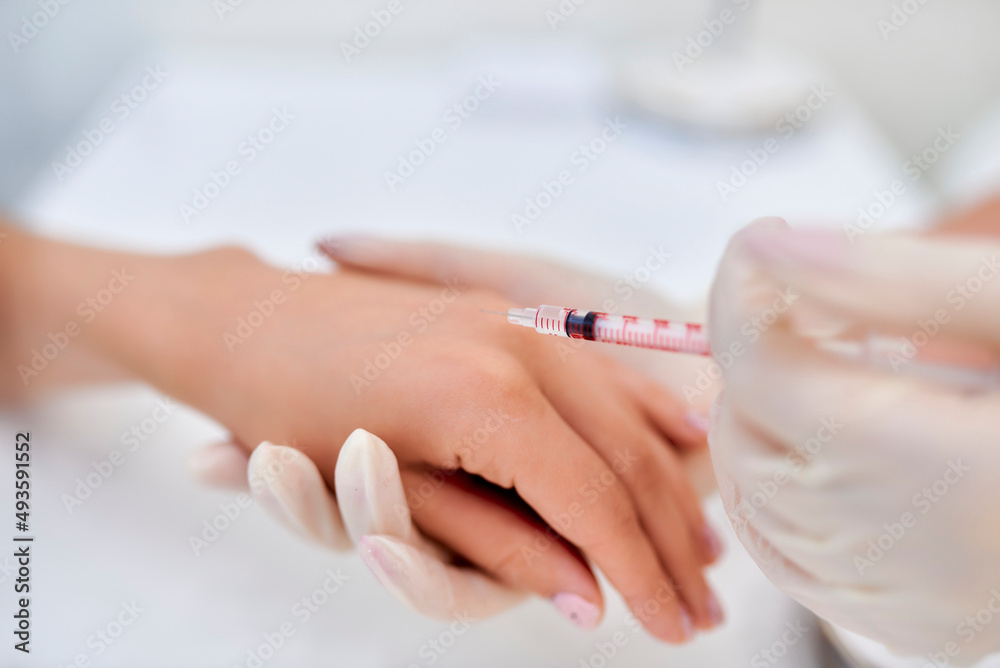 The doctor makes an injection in the hand The doctor makes an injection in the hand