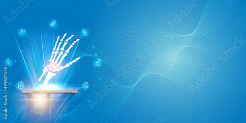 Technology for treatment of bone hand injury. Abstract traumatology and orthopedics. Medical science in the hospital for body joints.